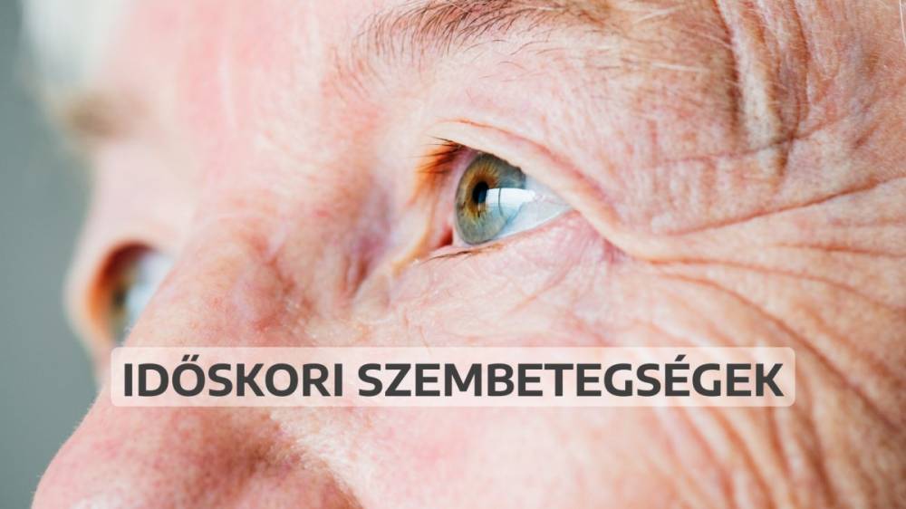 Szemünk fénye: időskori szembetegségek